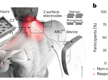 Spinal cord treatment restores function for paralyzed patients in study: ‘New hope’