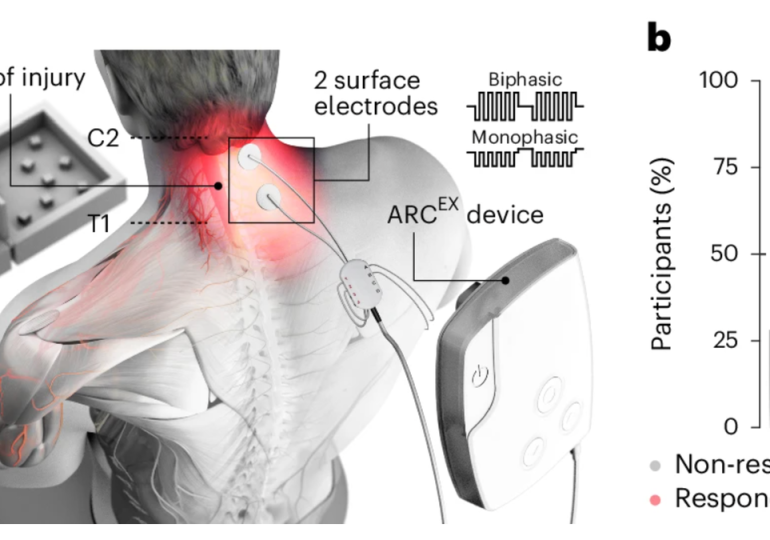 Spinal cord treatment restores function for paralyzed patients in study: ‘New hope’