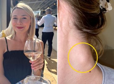 Woman's painful reaction to wine leads to life-changing cancer discovery