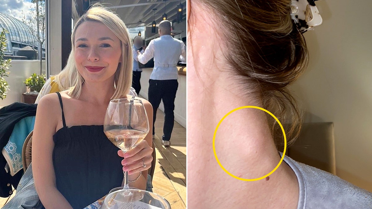Hollie Thursby holds a glass of white wine next to an image of a lump in her neck