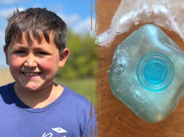 Dangerous TikTok trend leaves boy badly burned as doctors issue warning