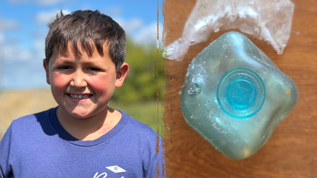 Boy burned by NeeDoh toy