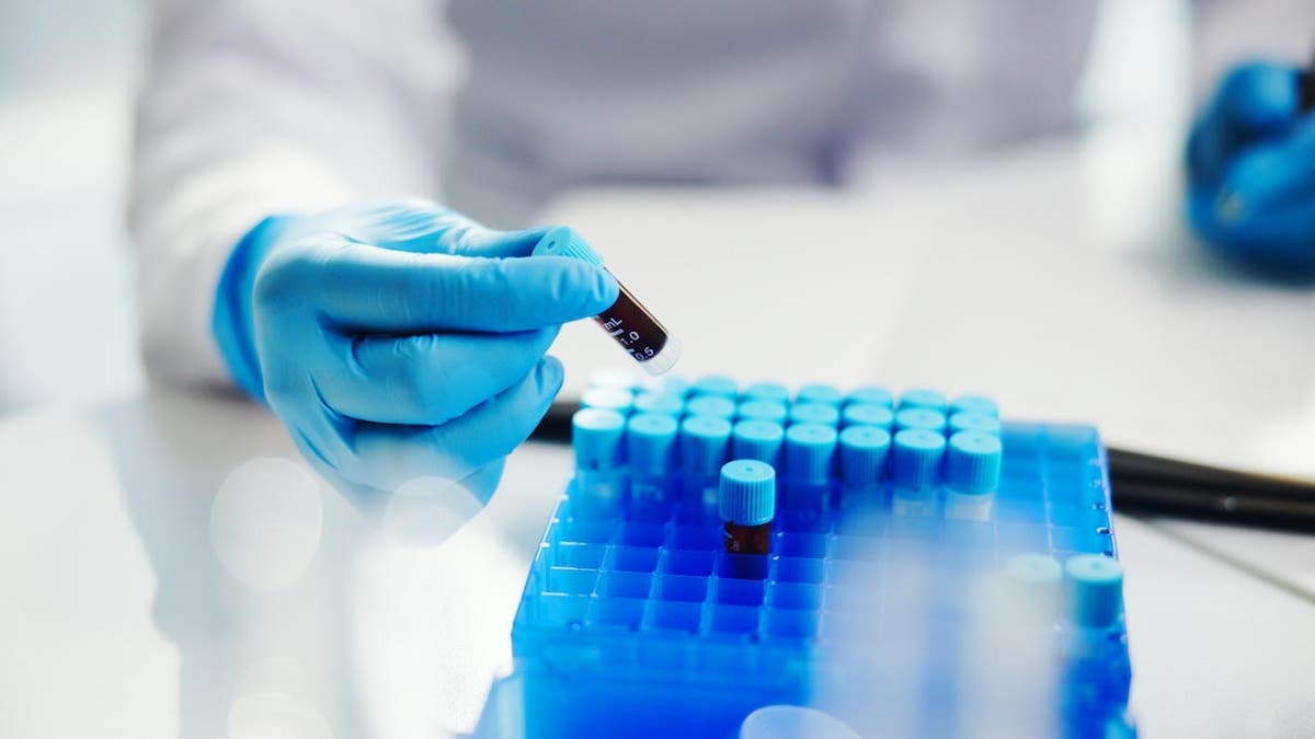 Scientist holding blood vial with gloved hand in laboratory setting